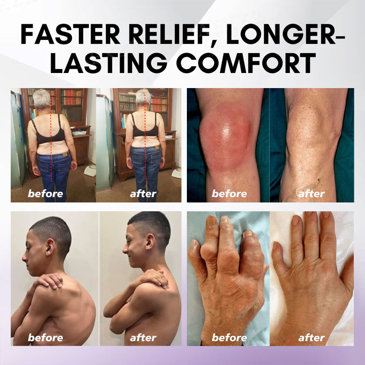 ODEIUN™ Turmeric & Emu Oil Arthritis Soothing Pain Relief Massage Gel 👨⚕️Canada Osteopathic Association (AOA)Approved