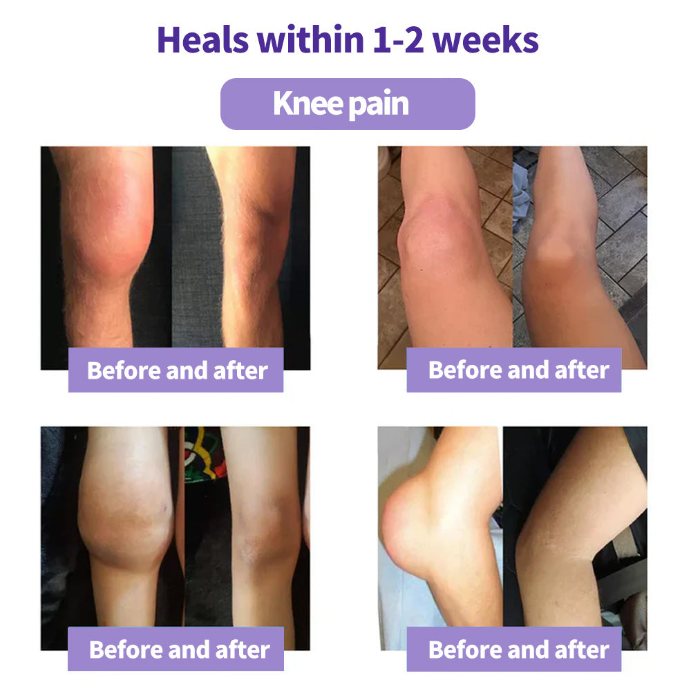 ODEIUN™ Turmeric & Emu Oil Arthritis Soothing Pain Relief Massage Gel 👨⚕️Canada Osteopathic Association (AOA)Approved