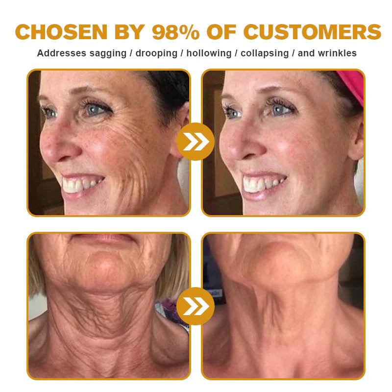 🎁Flash Sale - ODEIUN™ BOTOX Bee Venom Anti-Aging Serum - Suitable for all skin types🐝💎