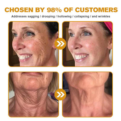 🎁Flash Sale - ODEIUN™ BOTOX Bee Venom Anti-Aging Serum - Suitable for all skin types🐝💎