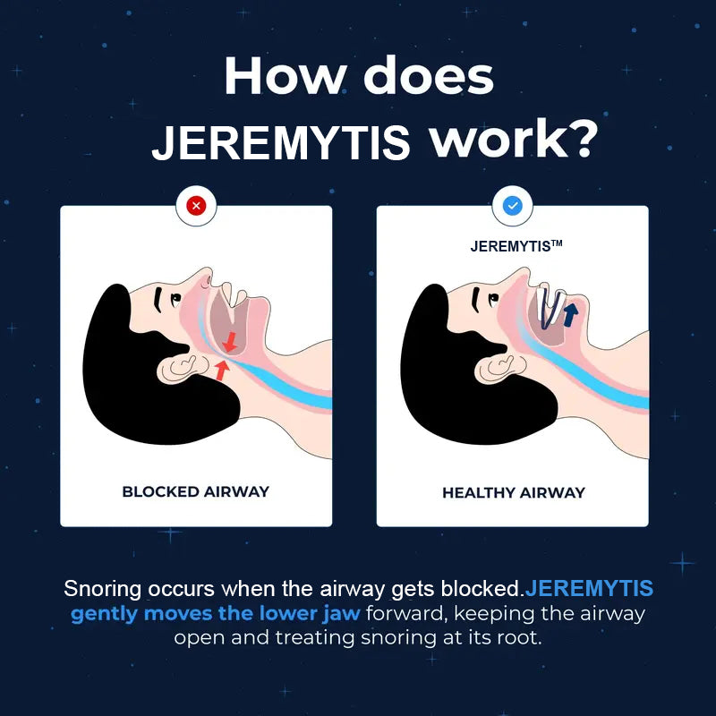 🔥[Official Brand Store] JEREMYTIS™ Adjustable Anti-Snoring Mouthpiece