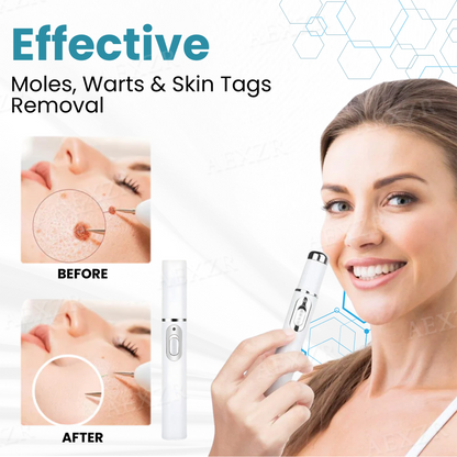 JEREMYTIS® Non-Invasive Mole and Wart Removal Laser Pen