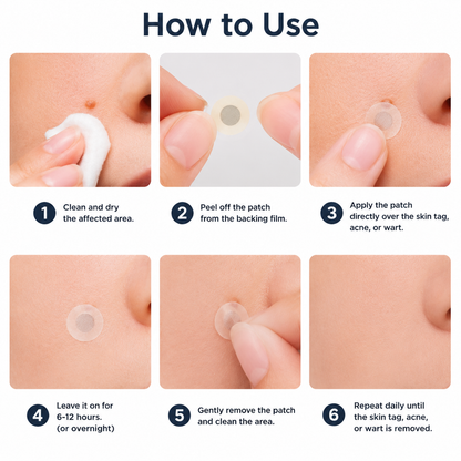✅🇺🇸𝐇𝐞𝒂𝒍𝗿𝗶𝙯𝙚®2-in-1 Microneedle & Hydrocolloid Patch🎀| Removes Raised Moles, Acne, Flat Warts & Skin Tags | Helps Improve Wrinkles, Scars & Blemishes | Invisible Patches for Face & Body