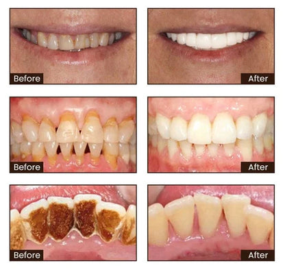⏰[Official Brand Store 24-Hours Promotion]" JEREMYTIS™ Ultra Whitening Mint Toothpaste✨"