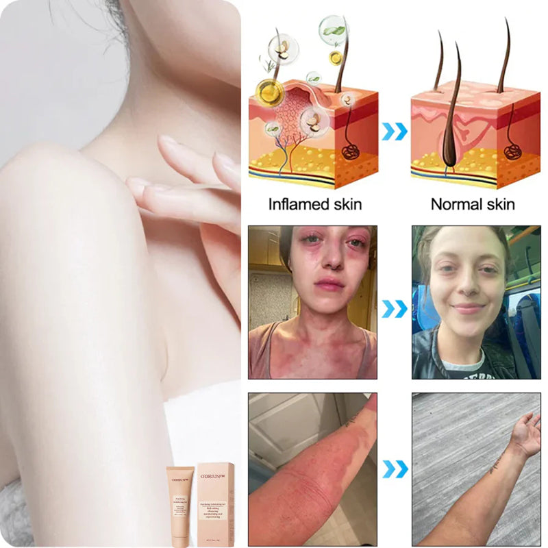 ODEIUN™ Purifying Exfoliating Gel for Acanthosis Nigricans, Exfoliation, Dark Spots, Skin Tags, and Eczema